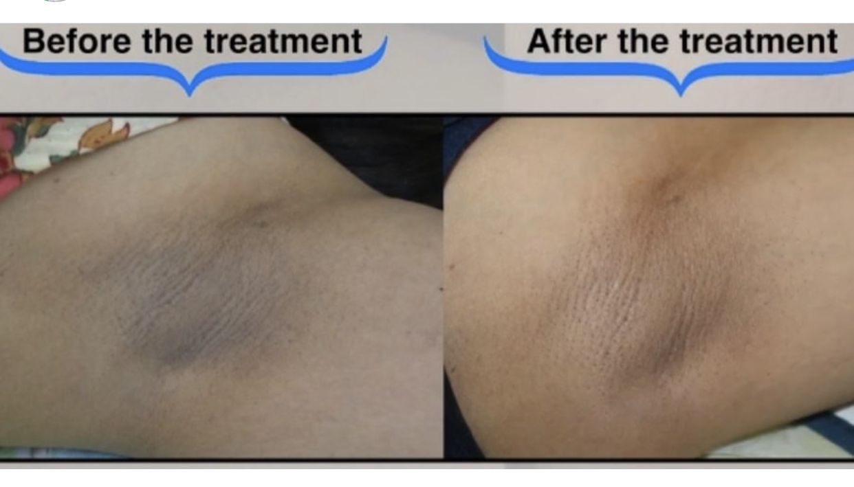 Transformation 1 - Dr. Siham Bennis