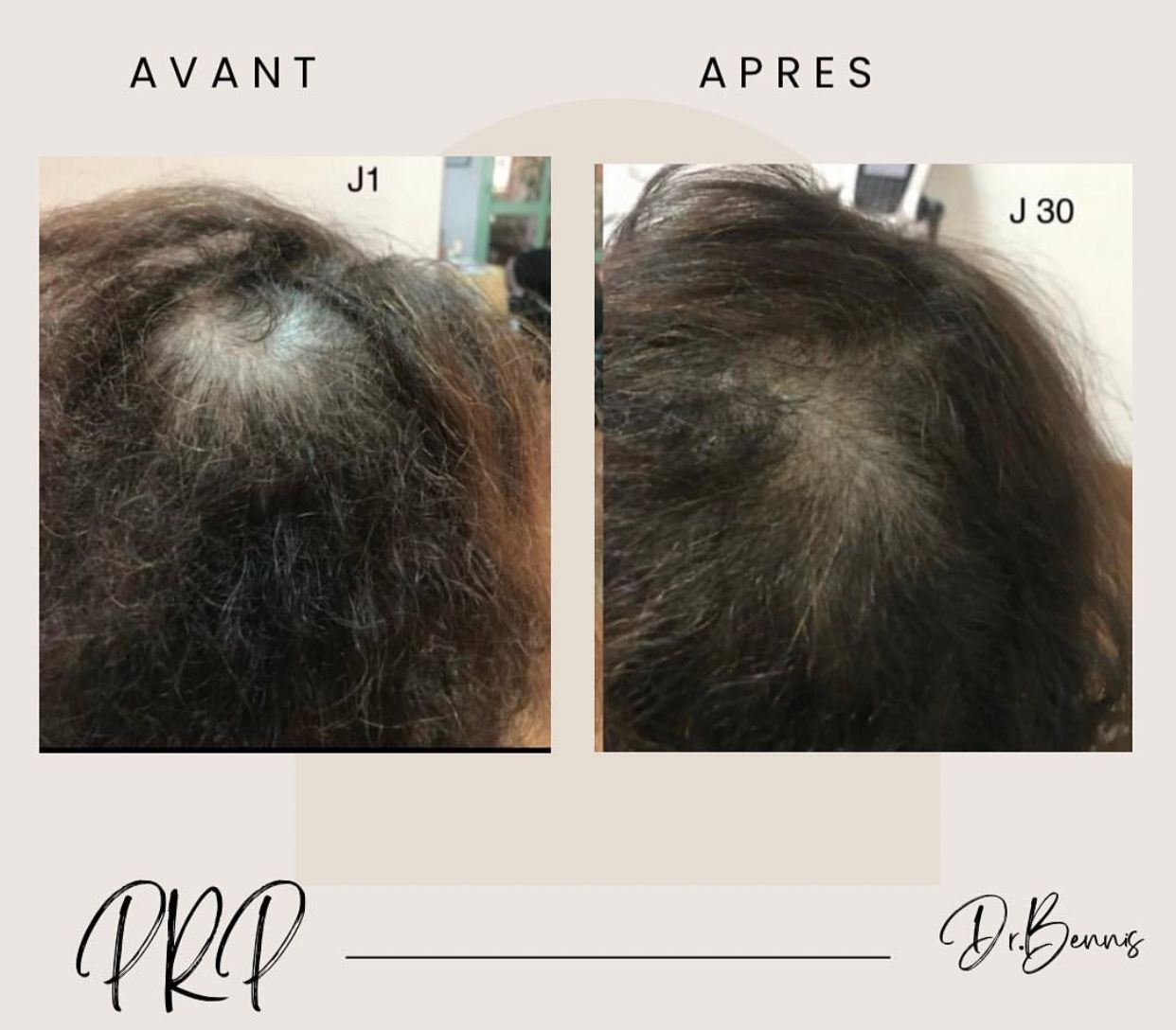 Transformation 3 - Dr. Siham Bennis