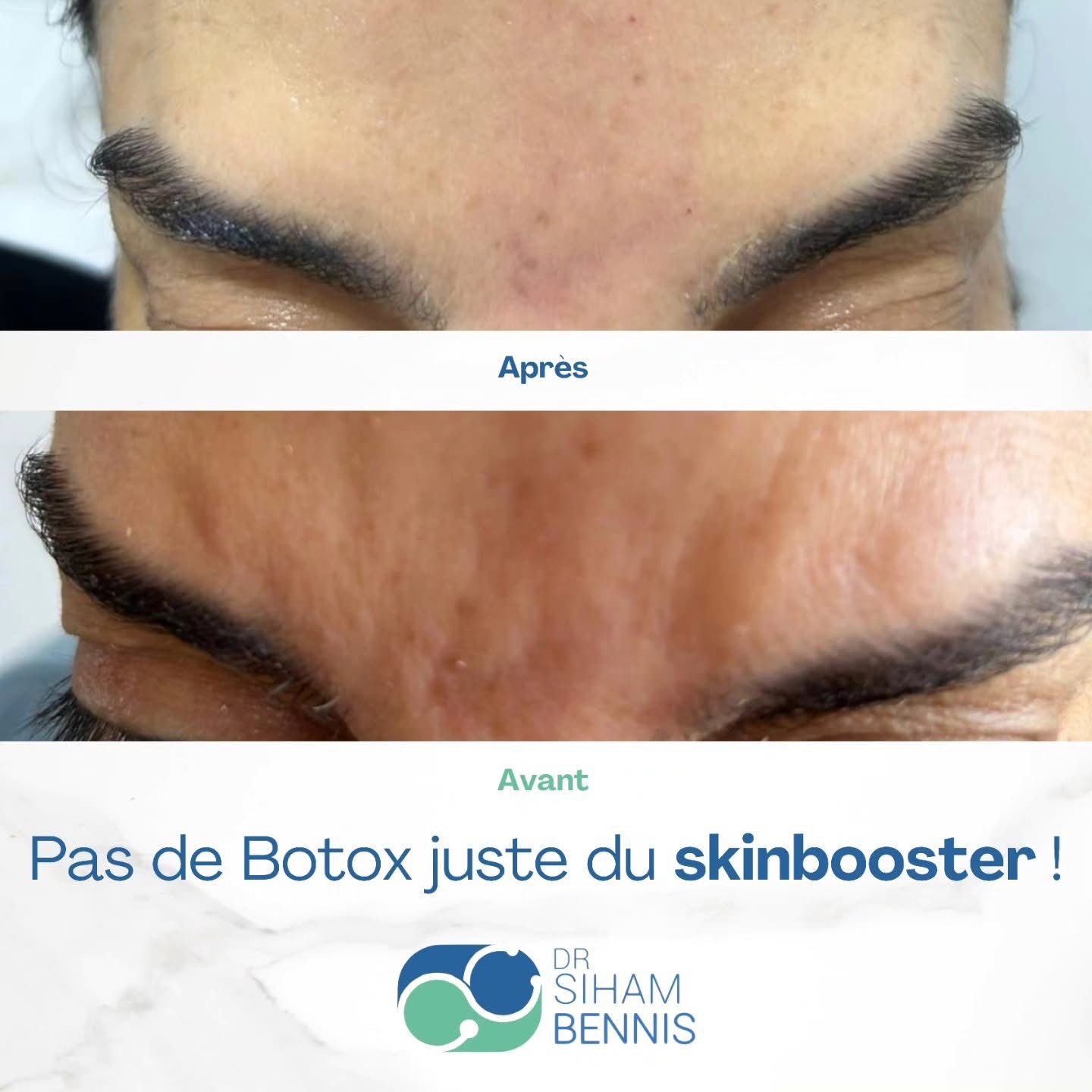 Transformation 4 - Dr. Siham Bennis