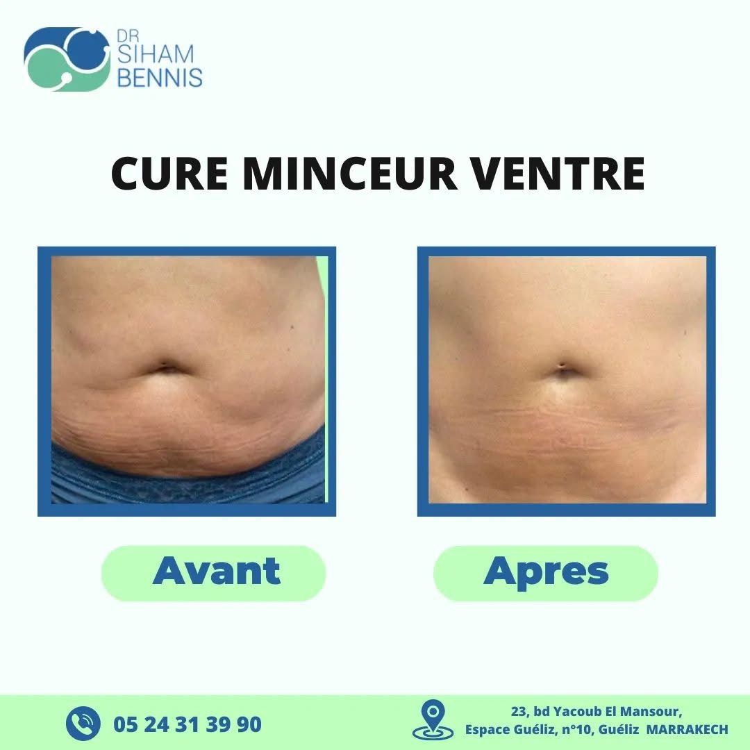 Transformation 5 - Dr. Siham Bennis