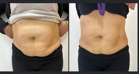 Transformation 8 - Dr. Siham Bennis